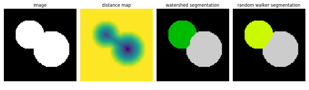 image, distance map, watershed segmentation, random walker segmentation